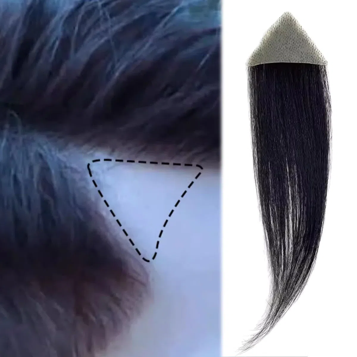 Haarpflaster am vorderen Haaransatz, Ersatz aus menschlichem Haar, Verbrennungen ohne Haare für kahle Stellen, Toupet, Vertuschung von Haarausfall bei Männern/Frauen(6cm,4.5 * 4.5 * 4)