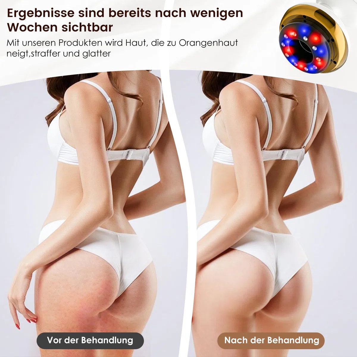 Vacuvia Cellulite Massager, 4-in-1 Vakuum Massagegerät gegen Cellulite mit Wärmetherapie & LED-Licht, Elektrisches Schröpfgerät für Lymphdrainage, Anti-Cellulite Massagegerät