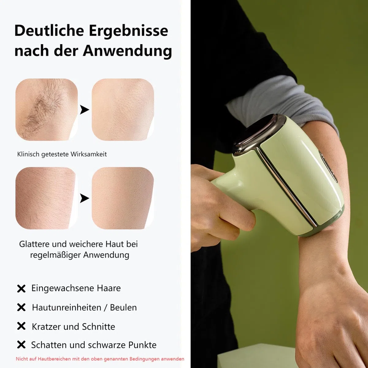 IPL Haarentfernungsgerät schmerzfrei für Damen (Beine, Gesicht, Bikini) | Eispunkt-Kühltechnologie für Arme und Achseln als perfekte Vorbereitung auf den Sommerurlaub