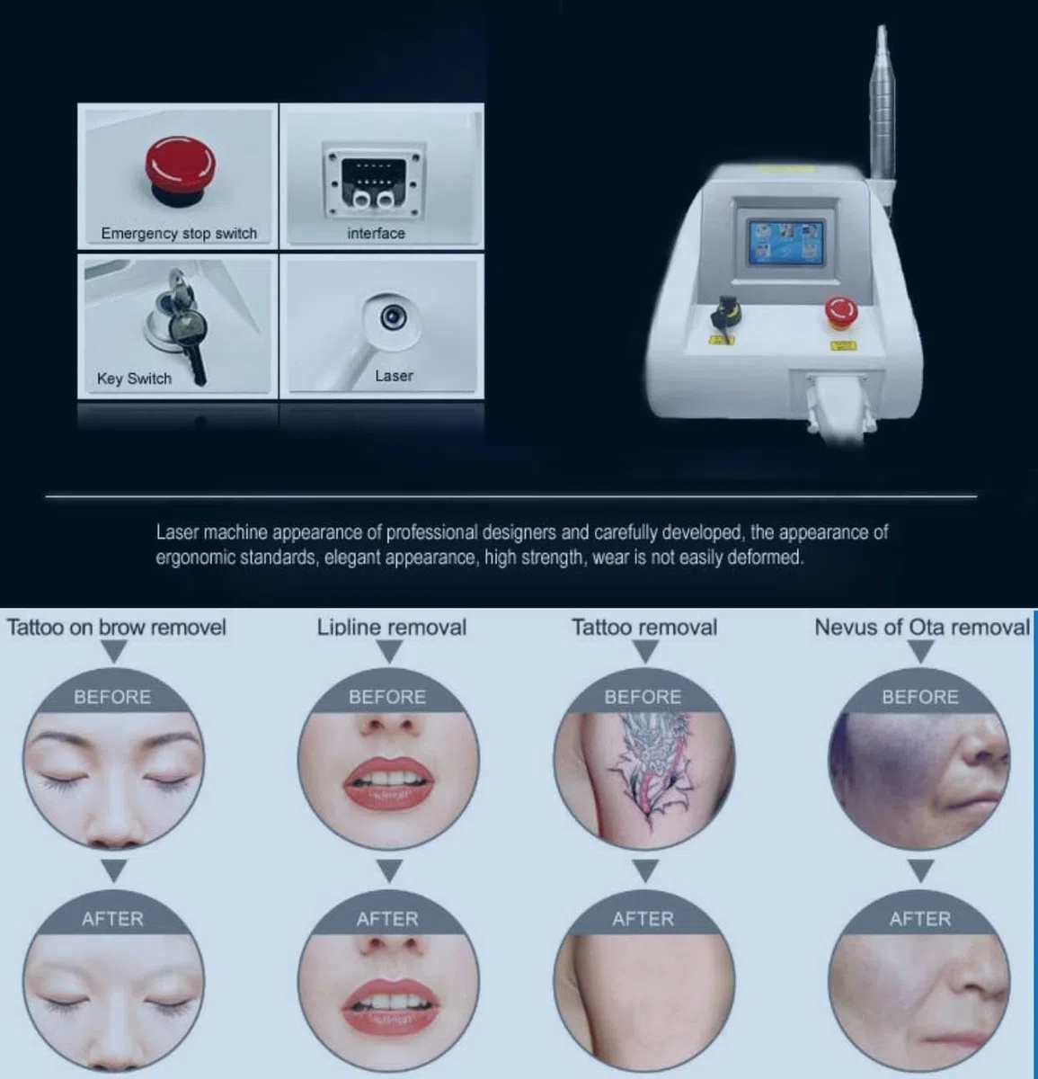 Laser-Tattoo-Entfernung, Laser-Maschine, Tattoo-Entfernungsgerät, Augenbrauen-Tattoo, Lippen-Tattoo, Auge, Pigment entfernen, Flecken entfernen, Kühlsystem-Maschine, professionelles